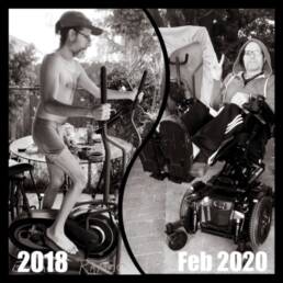 Eduardo Ramos during his recovery. On the left, Eduardo is using an eliptical machine during 2018. On the right, Eduardo is sitting is his tilt recline mobility chair in Febuary 2020.